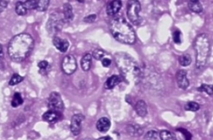 Case 1 Image