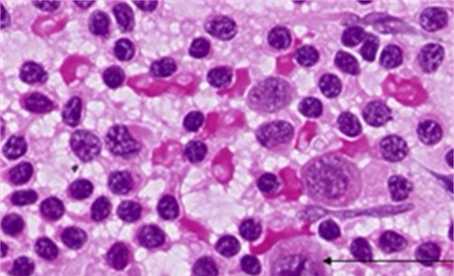 Case 2 Image