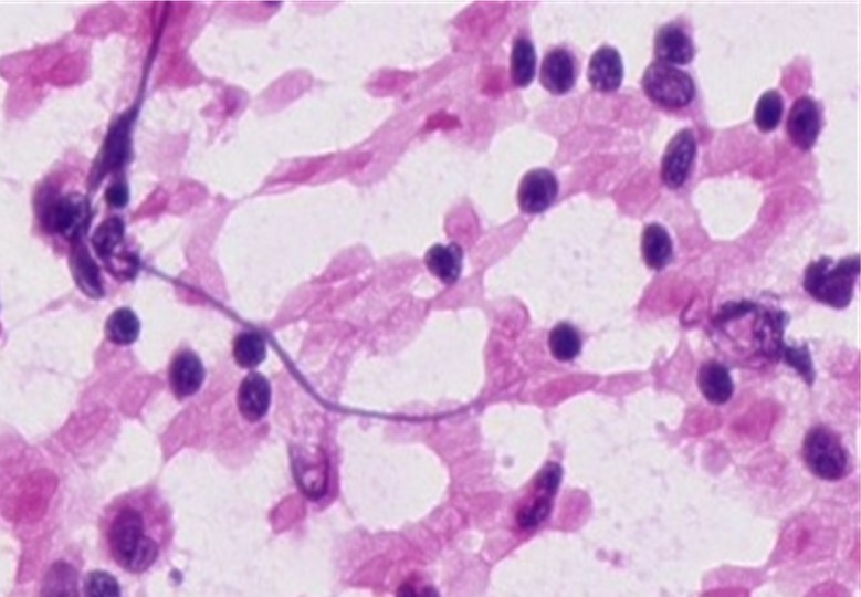 Case 3 Image