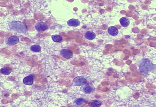 Case 4 Image